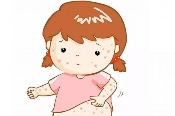 为什么会有瘊子,为什么会起痱子