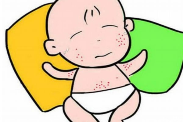 瘊子的症状,手上长瘊子有什么症状