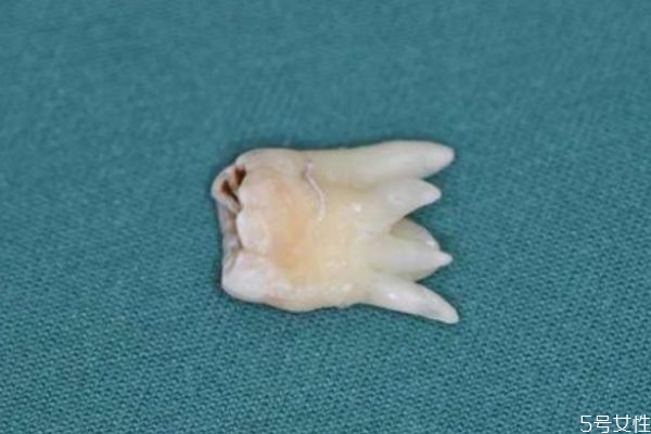 每个人都会长智齿吗?长智齿代表什么,每个人都会长智齿吗?