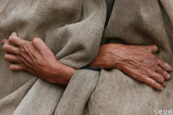 麻风病疑似症状有哪些,麻风病是怎么得的