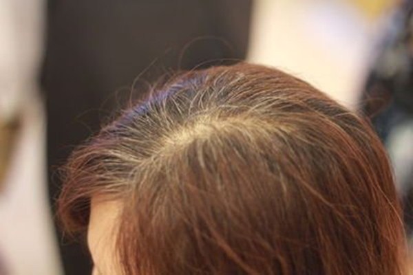 头发白可以多吃什么,头发白多吃什么食物 头发白可以多吃什么,头发白多吃什么食物