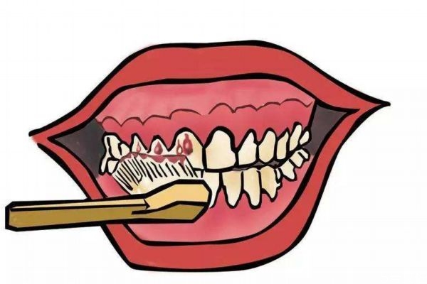 牙龈红肿是什么原因导致的,牙龈红肿是为什么