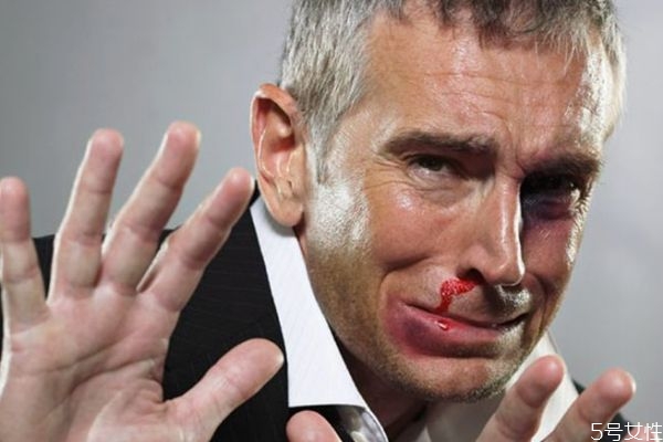 鼻子出血应该怎么治疗,鼻子出血有什么好的治疗办法