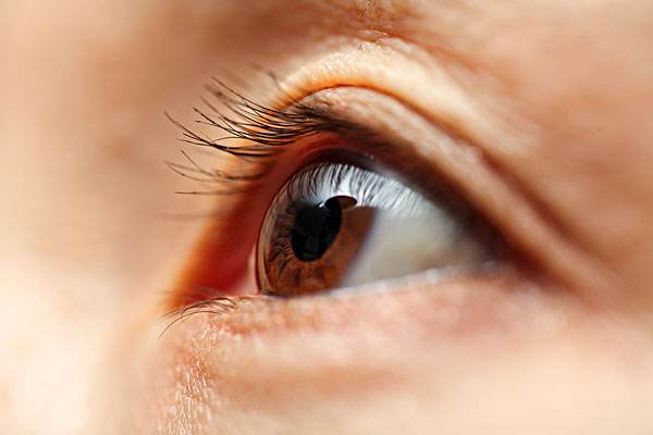 如何治疗沙眼,治疗沙眼的最好方法