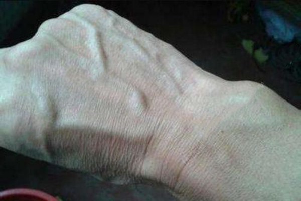 血管粗的好还是细的好?,血管粗好还是血管细好