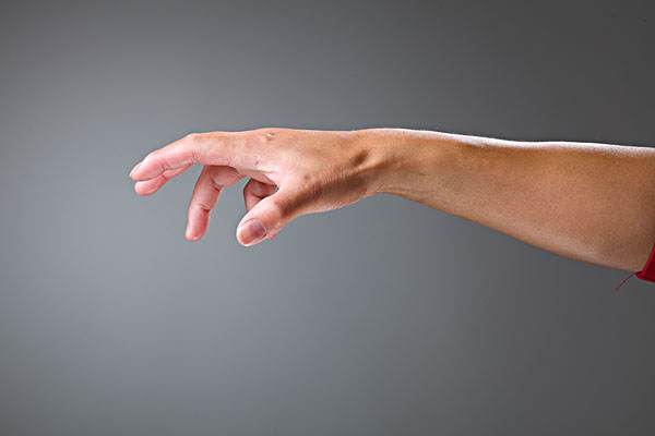 经常掰手指会导致关节炎吗,掰手指会不会得关节炎?