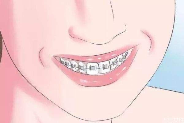 牙齿做脱敏治疗大概要多少钱,牙齿脱敏价格