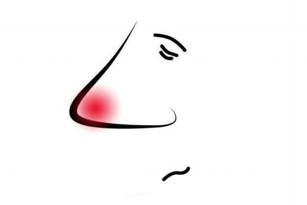 感冒鼻子发红,鼻子里面特别红是感冒还是鼻炎