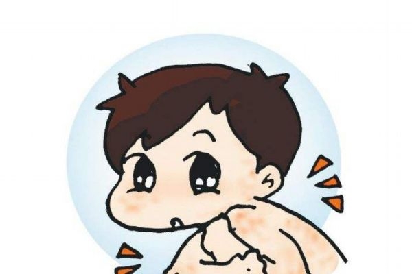 湿疚怎么治,湿疹,如何治疗