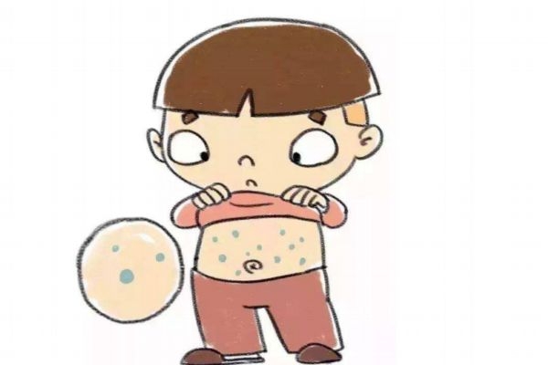 水痘有啥危害,得水痘的危害有多大