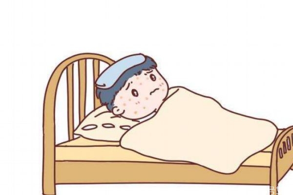 预防小儿麻疹最有效的措施,小儿麻疹应该怎么治疗