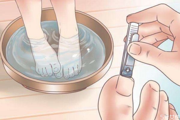 如何治疗灰指甲,有什么办法治疗灰指甲