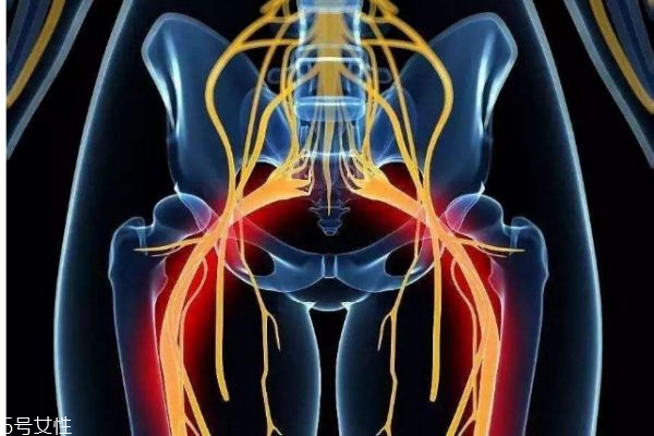 坐骨神经痛应该怎么治疗呢,坐骨神经痛该如何治疗 坐骨神经痛应该怎么治疗呢,坐骨神经痛该如何治疗