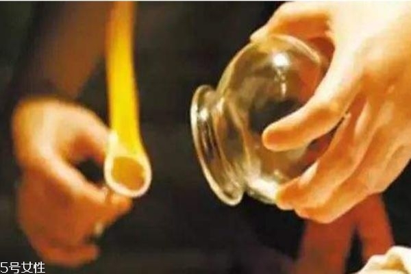 哪些人群不适合拔罐,什么人适合拔罐什么人不适合拔罐 哪些人群不适合拔罐,什么人适合拔罐什么人不适合拔罐