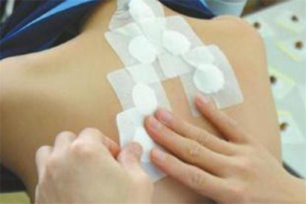 三伏贴长毛什么原因,三伏贴是干嘛的