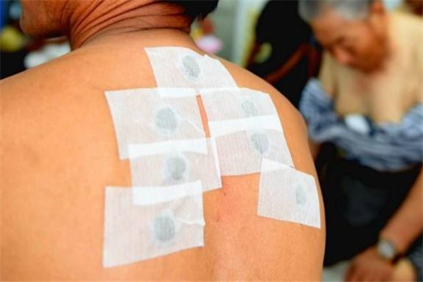 所有的三伏贴都是一样的吗,三伏贴到底有没有用