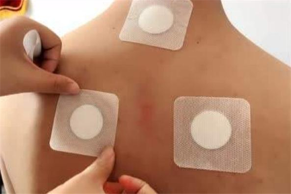 贴三伏贴不能吃什么东西,贴三伏贴不能吃什么水果