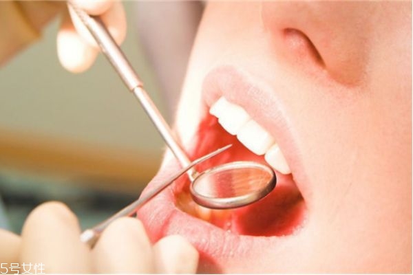 牙齿容易结石是什么原因,牙结石的形成原因