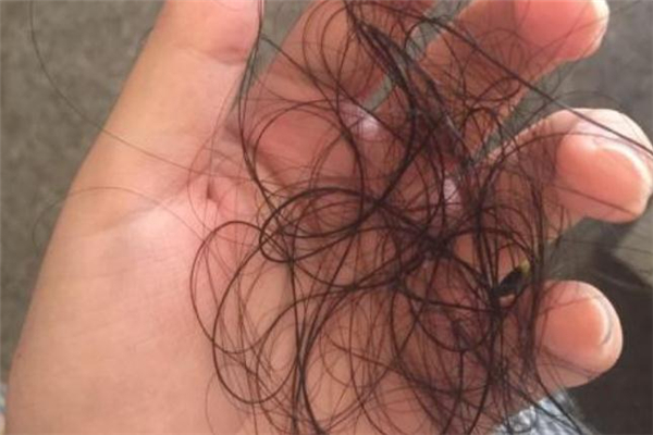 头发是干垃圾还是湿垃圾啊,头发是干垃圾吗 头发是干垃圾还是湿垃圾啊,头发是干垃圾吗