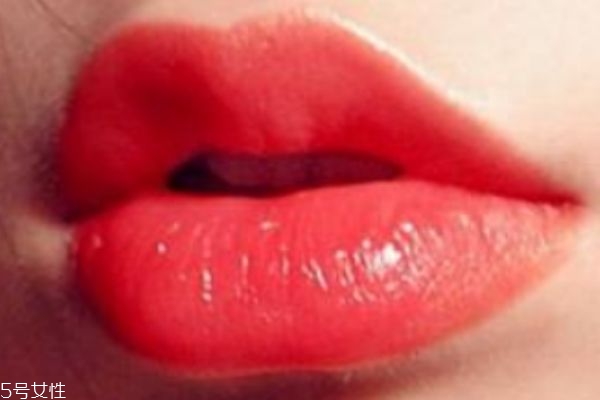 哪些疾病会引起,引起的疾病