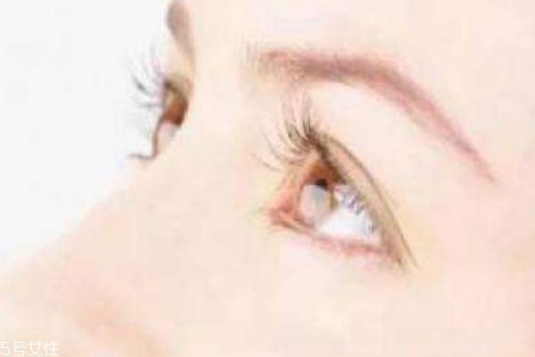 迎风流眼泪是怎么回事,遇风流眼泪是什么原因迎