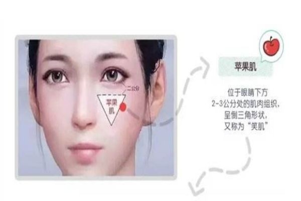 苹果肌是什么意思,苹果肌是什么脸型 苹果肌是什么意思,苹果肌是什么脸型