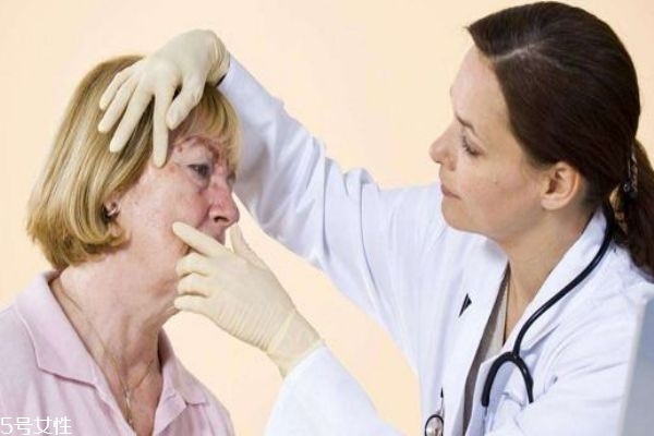 脂溢性皮炎原因及治疗,脂溢性皮炎根治 脂溢性皮炎原因及治疗,脂溢性皮炎根治