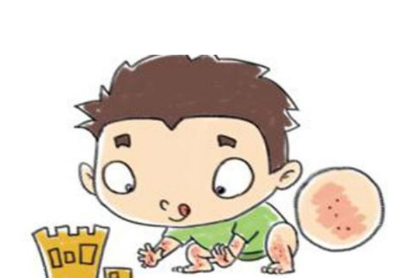 神经性皮炎的护理,神经性皮炎的护理措施 神经性皮炎的护理,神经性皮炎的护理措施