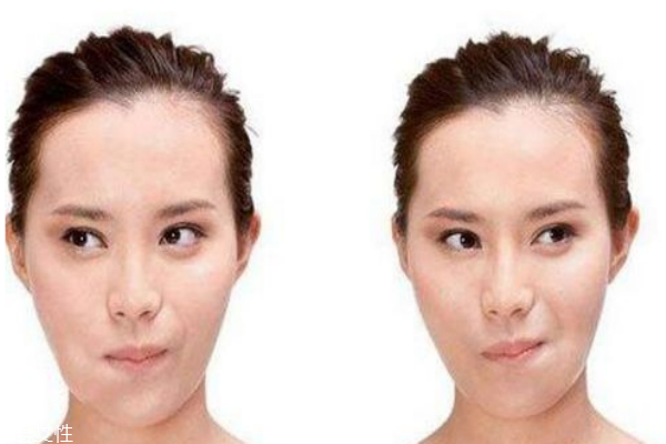 口角炎是什么原因造成的,口角炎的原因和症状及治疗?