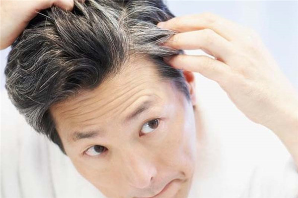 头发早白的原因引起的,男人头发早白的原因