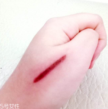 创可贴使用时间不宜超过,创可贴不能贴太长时间