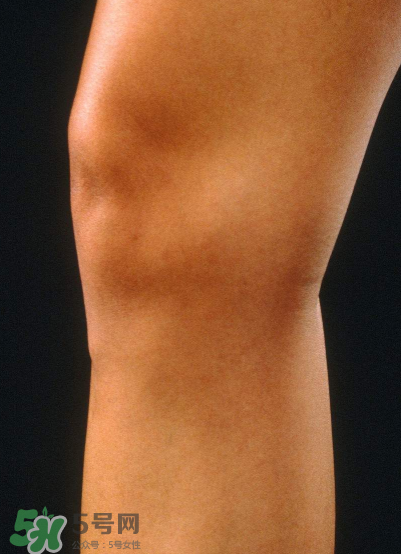 风湿会遗传吗(风湿病会遗传给下一代吗)