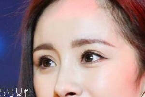 叶黄素对皮肤的作用,叶黄素效果