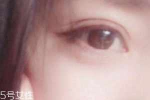 服用叶黄素的注意事项,叶黄素如何服用