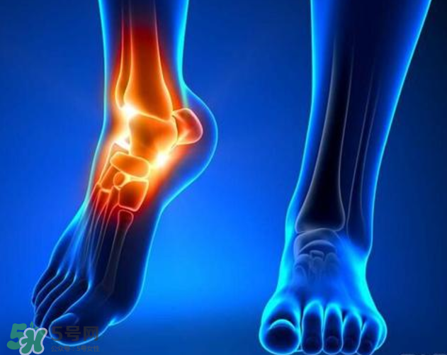 风湿吃什么好(有风湿的人吃什么好)