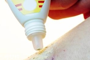 息斯敏和氯雷他定片哪个效果好,氯雷他定和息斯敏哪个治疗过敏更好