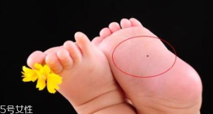 宝宝身上的痣,宝宝身上的哪些痣有福气