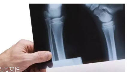 冻出来的疾病,冰冻病是什么