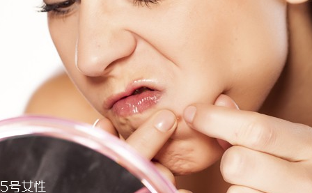 为什么糖吃多了会长痘,吃糖是导致痘痘的主要原因吗