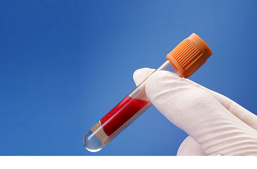 高血脂是如何产生的,什么叫高血脂 怎么引起的