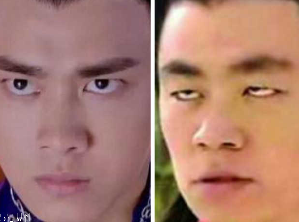 哪些明星是死鱼眼,哪个明星被称为死鱼眼