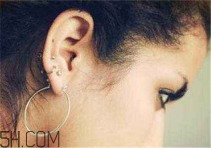 打了耳洞要注意的事项,打耳洞前要注意什么