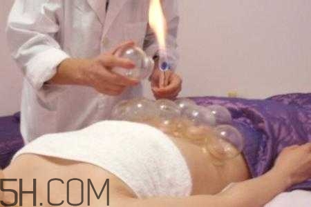 拔罐减肥的原理是什么身上的肉去哪里了,拔罐减肥的原理及危害