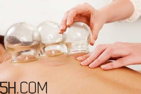 拔罐治疗鼻炎的方法,鼻炎拔罐拔哪个位置治疗