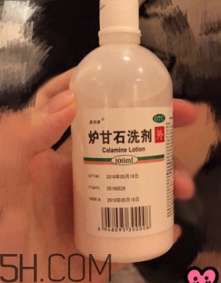 白色洗剂是炉甘石吗,炉甘石洗剂使用指南