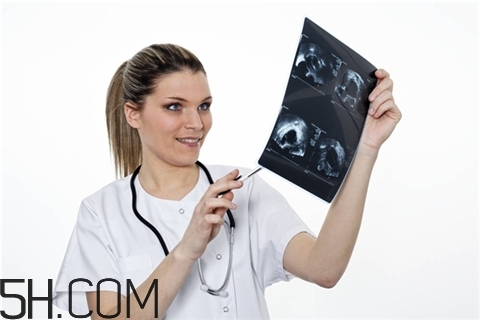 骨折后吃什么药好得快,骨折了吃什么好得快