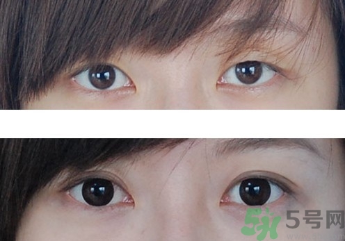 长时间贴双眼皮贴会成双眼皮吗,三眼皮贴双眼皮贴能恢复吗