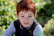 脸上点完雀斑需要注意什么,脸上有哪些雀斑不能点