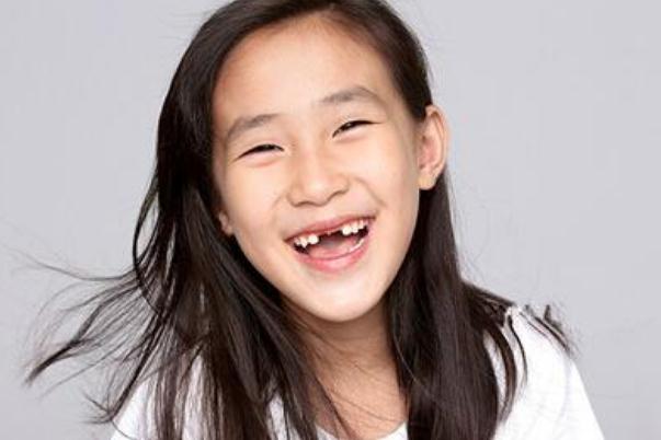 儿童换牙的注意事项(儿童换牙注意事项有哪些) 儿童换牙的注意事项(儿童换牙注意事项有哪些)