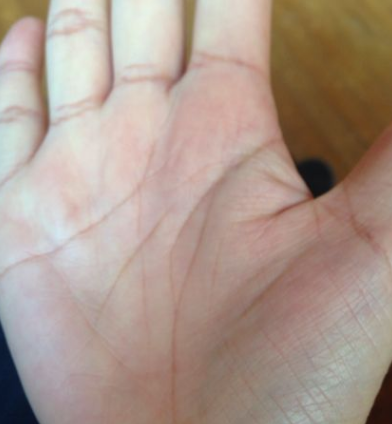 生命线短寿命就会短吗(生命线短就是寿命短吗)